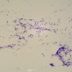 Cocci (bacteria)