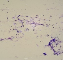 Cocces (bactéries)