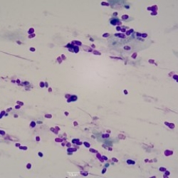 Malassezia pachydermis ( yeast )