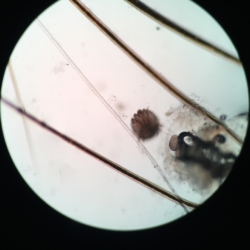 Scabies ( Sarcoptes scabiei)