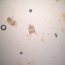 Ear mites (Notoedres cati)